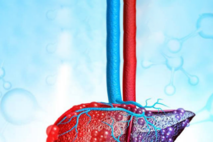 eat-these-five-things-to-keep-your-liver-healthy-03